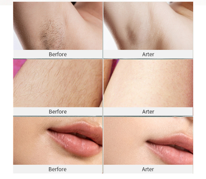 Portable household hair removal device