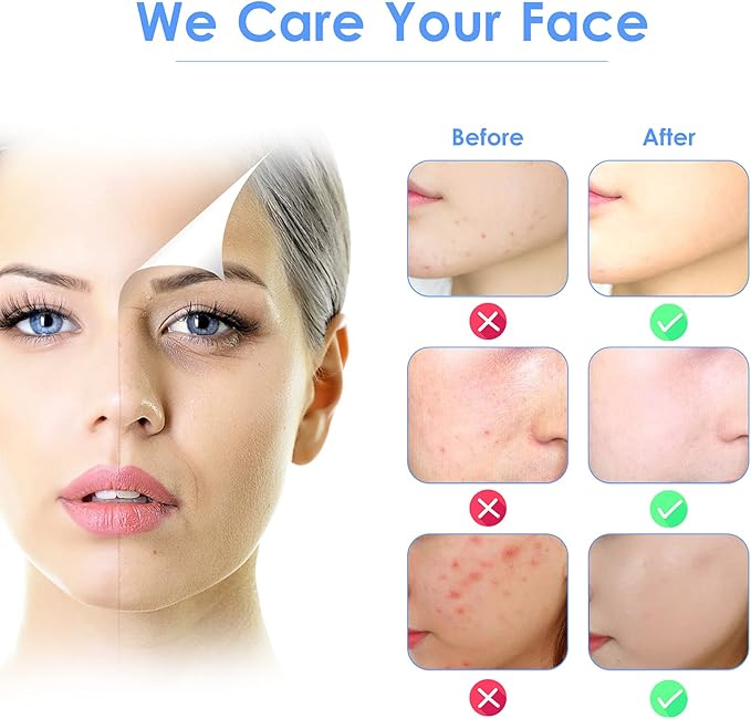 3-in-1 Ultrasonic Facial Skin Scrubber