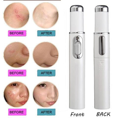 FDA-Cleared Blue Light Acne Killer | No-Skin-Contact Design