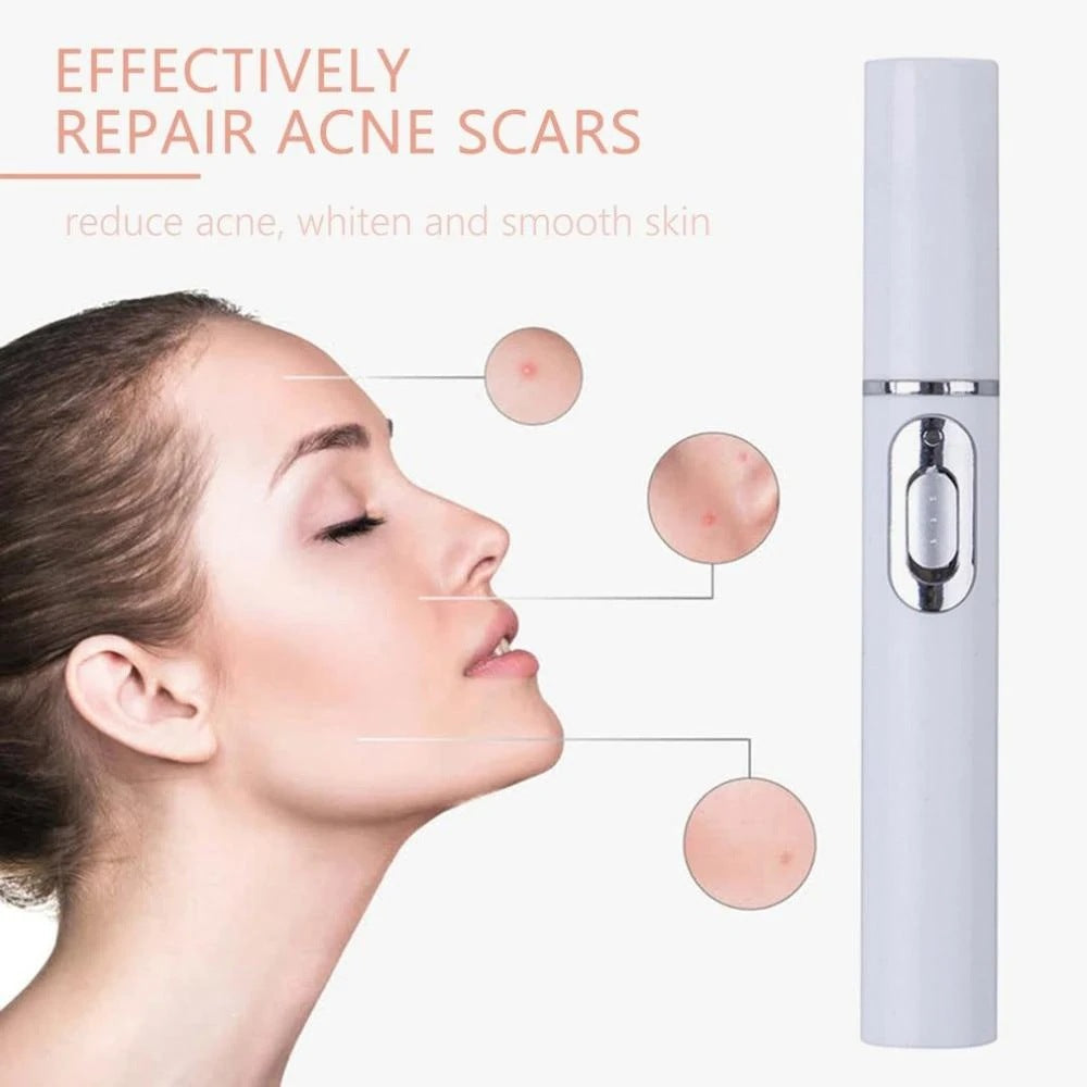 FDA-Cleared Blue Light Acne Killer | No-Skin-Contact Design