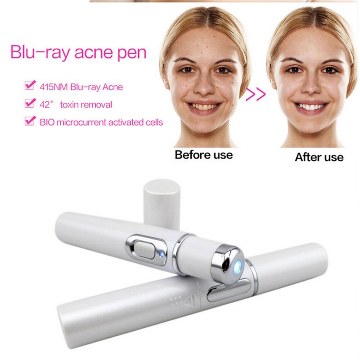 FDA-Cleared Blue Light Acne Killer | No-Skin-Contact Design