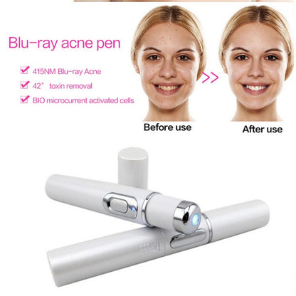 FDA-Cleared Blue Light Acne Killer | No-Skin-Contact Design